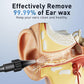 Electric Ear Wax Removal Kit – 1080P Camera