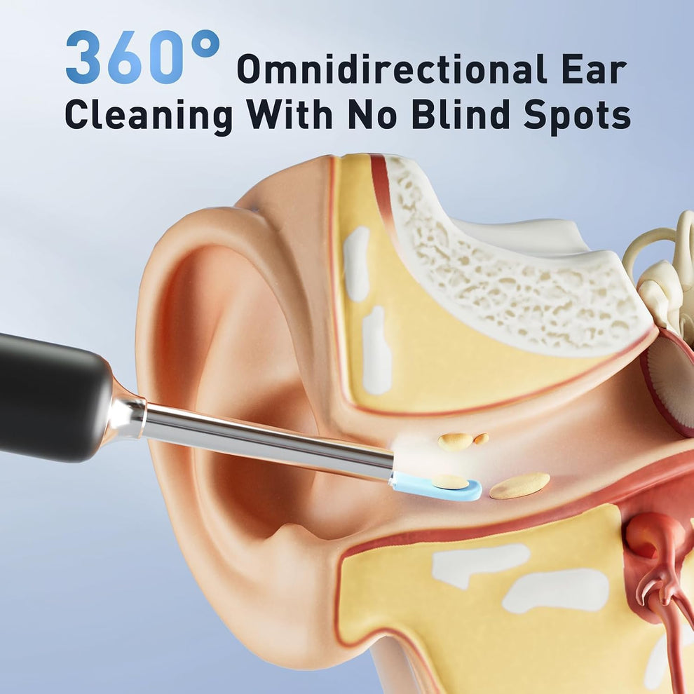 Electric Ear Wax Removal Kit – 1080P Camera