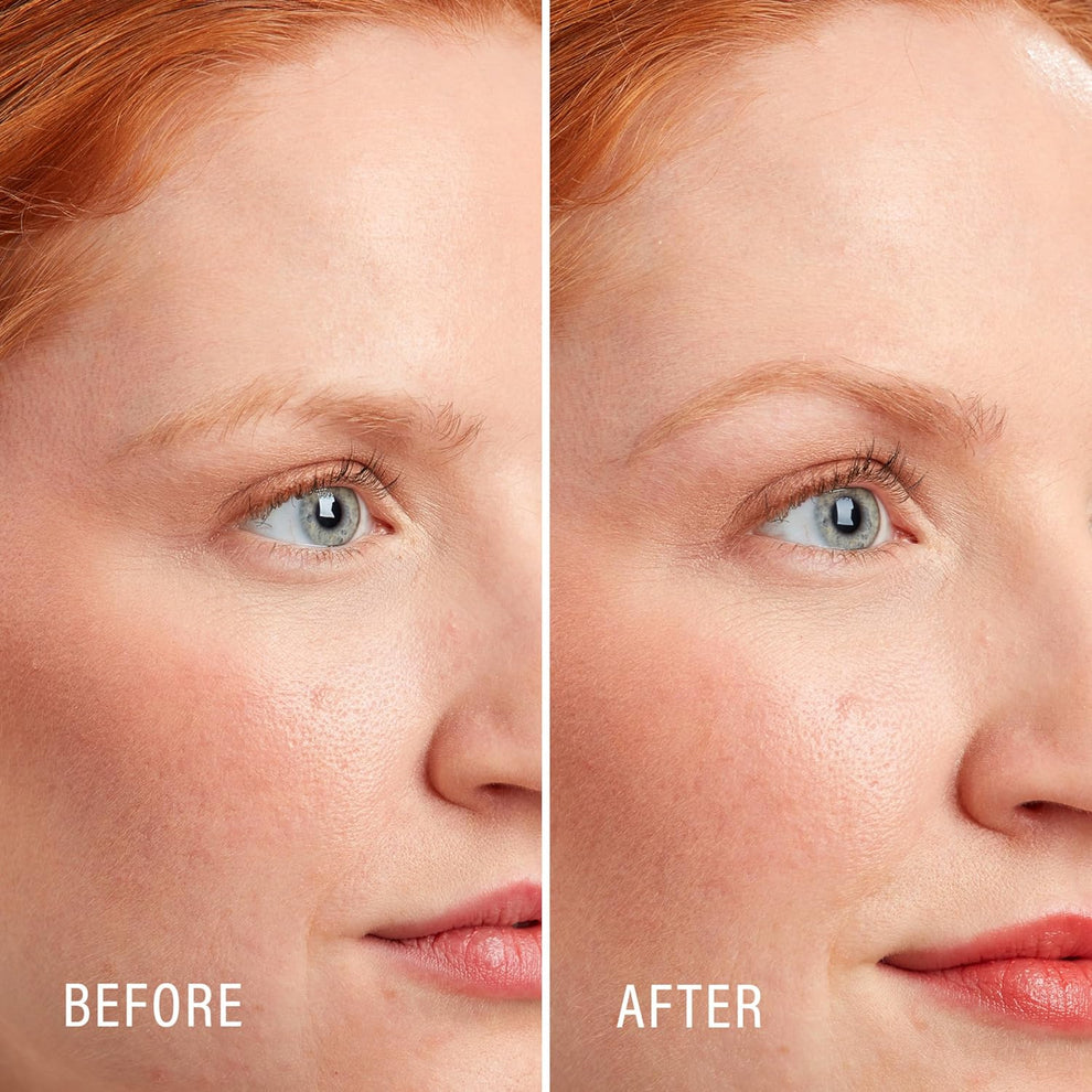 Dermaplaning Razors – 3ct Face Shavers for Women